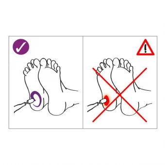 Bausch Schleifkappen Thermo 4 Bausch Schleifkappen Thermo – Bild 2