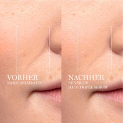 Lancome Lancôme Rénergie H.C.F. Triple Serum 50 Ml -Kosmetikgeschäft 1417770 Lancome Renergie H C F Triple Serum 50 ml.796e35d1