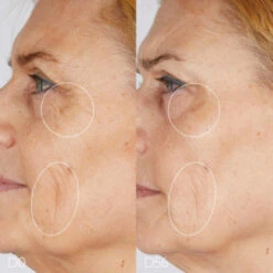 CAUDALIE Premier Cru Das Serum 30 Ml -Kosmetikgeschäft 2575159 CAUDALIE Premier Cru Das Serum 30 ml.b8850c3e