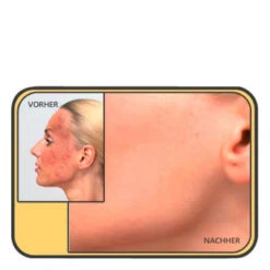 Dermacol Make-Up Cover 7 Dermacol Make-Up Cover -Kosmetikgeschäft 40285e4b6ab00a43016ab1c312804709 Dermacol Make Up Cover.a9ce8b39